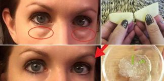 Göz Altı Morlukları Kolayca Nasıl Geçer? - Pratik Bilgiler - göz altı göz altı morlukları için krem göz altı morlukları karaciğer göz atı morlukları yorumlar